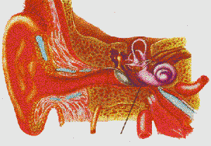 lésion oreille interne