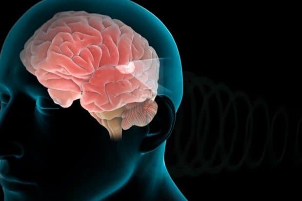 Stimulation du nerf vague