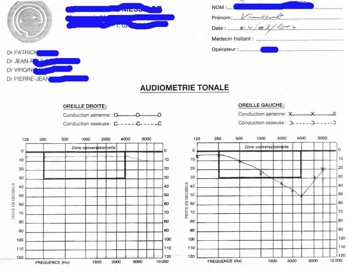 audiogramme musicien