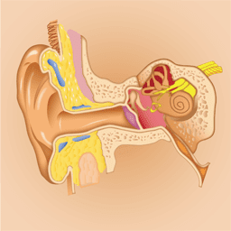 cause neurinome acoustique acouphène