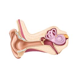 traitement implant cochléaire acouphène