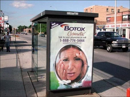 botox